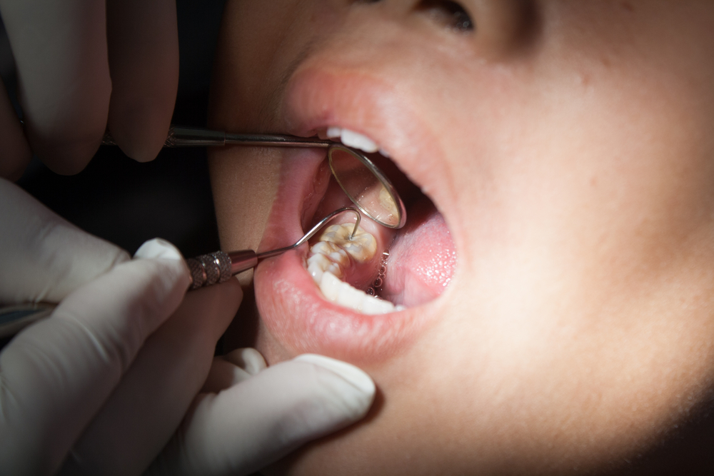 Dentaid targets vulnerable dental patients in pilot project in Bradford