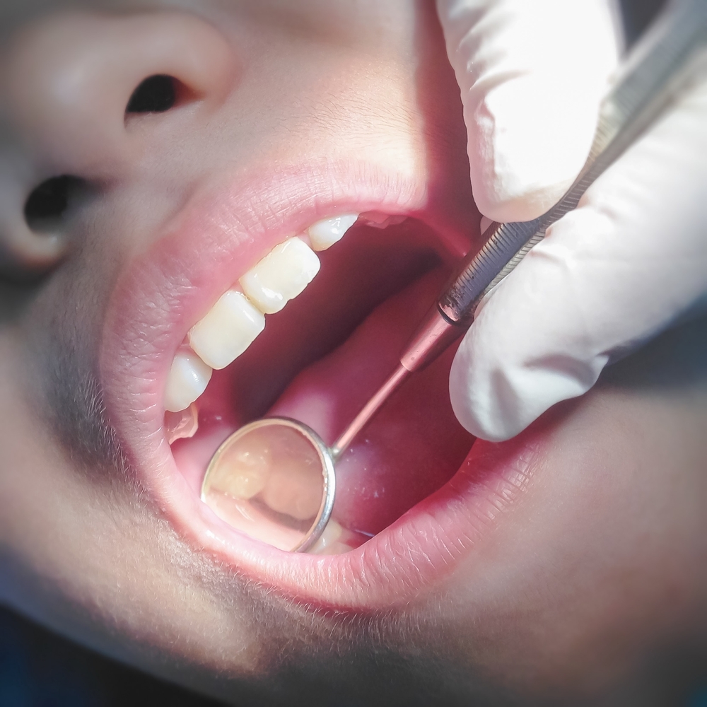 Irish dentists appeal for routine dental screenings in schools