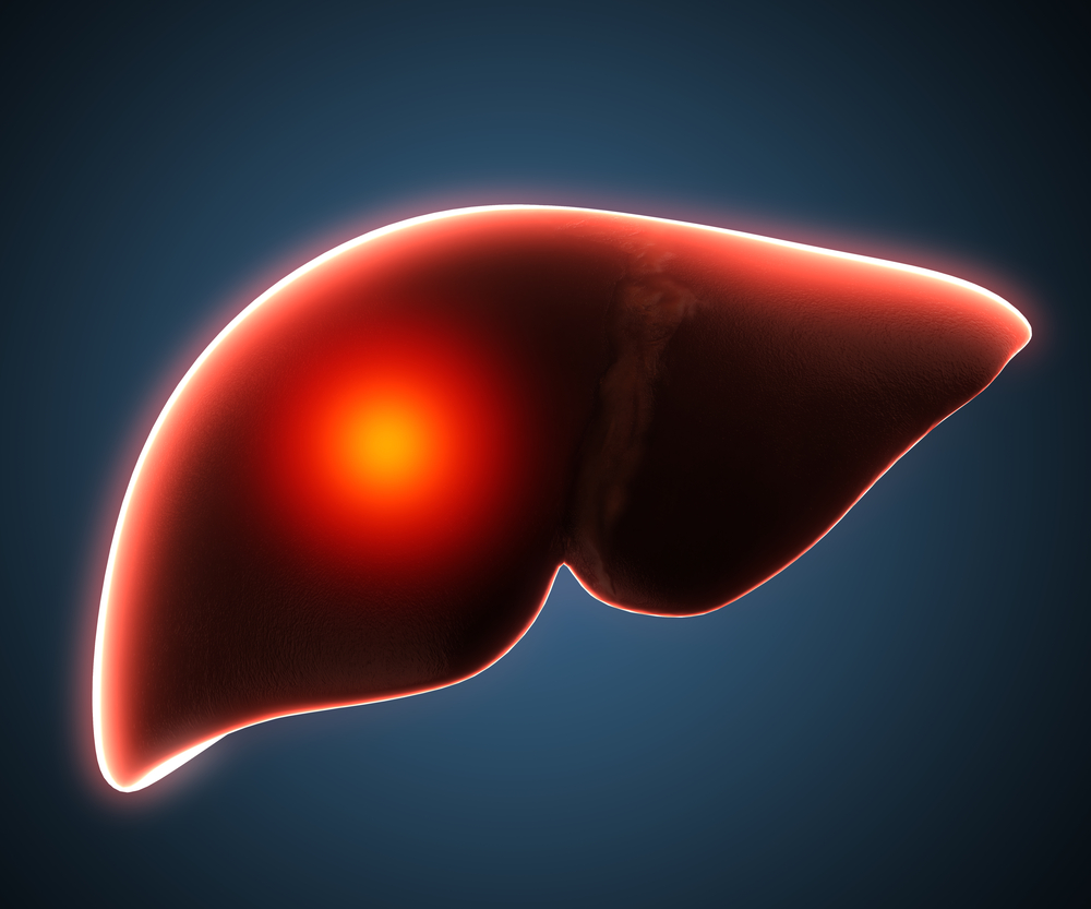 Study links poor oral health to higher death rates in patients with liver disease