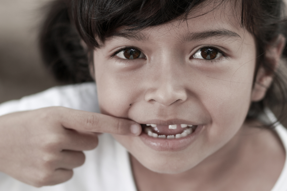 1 in 3 children suffer from tooth decay in Tayside