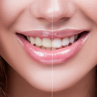 Woman fined by GDC said she had no idea that offering tooth whitening treatment was illegal