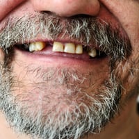 Volunteer dentists to provide free treatment for the homeless in Southampton