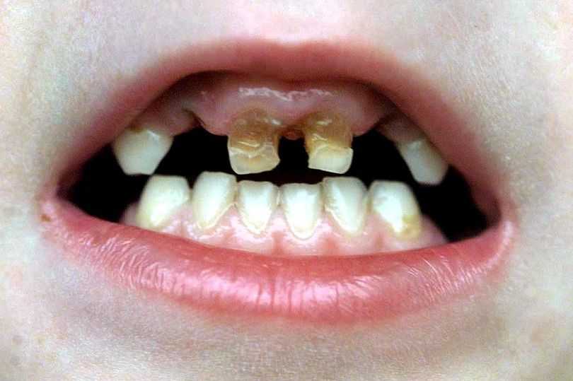 Dental experts raise concerns over North-South dental divide