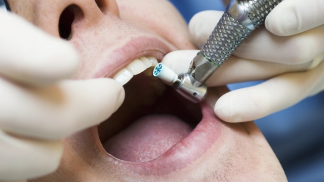 Zoom meetings inspire surge in requests for adult orthodontics