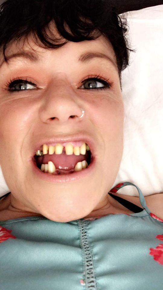 County Offaly woman warns against dental tourism after ending up with ‘shark teeth’
