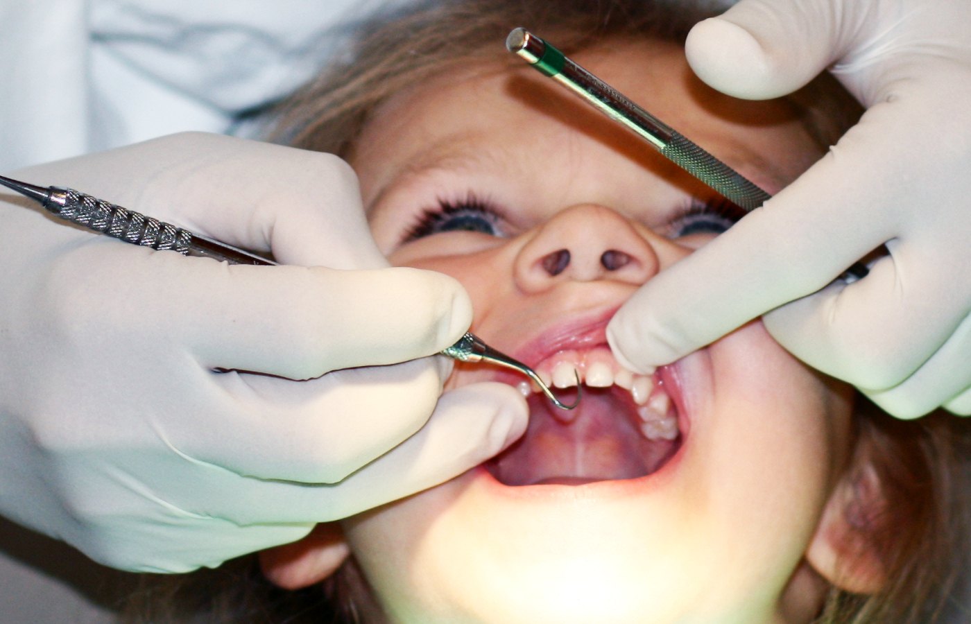 British Dental Association warns of widening oral health gap between wealthy and poor children in Scotland