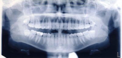 Charges for dental X-rays could be introduced in Guernsey