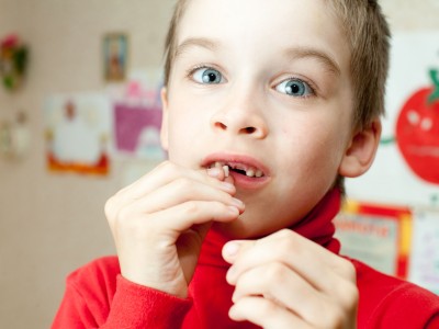 Top Doctor Voices Concerns About Child Tooth Decay 
