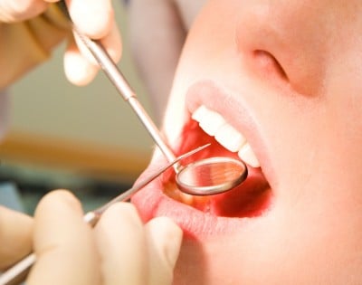 Leicester Dentist Highlights Oral Cancer Risks