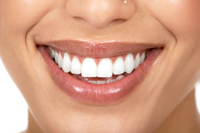 Northamptonshire Dental Receptionist Wins ‘Best Smile’ Award
