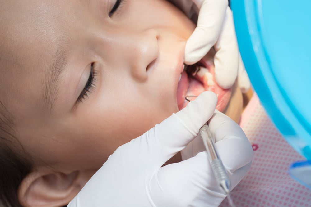 New figures show an 11% increase in child tooth extractions
