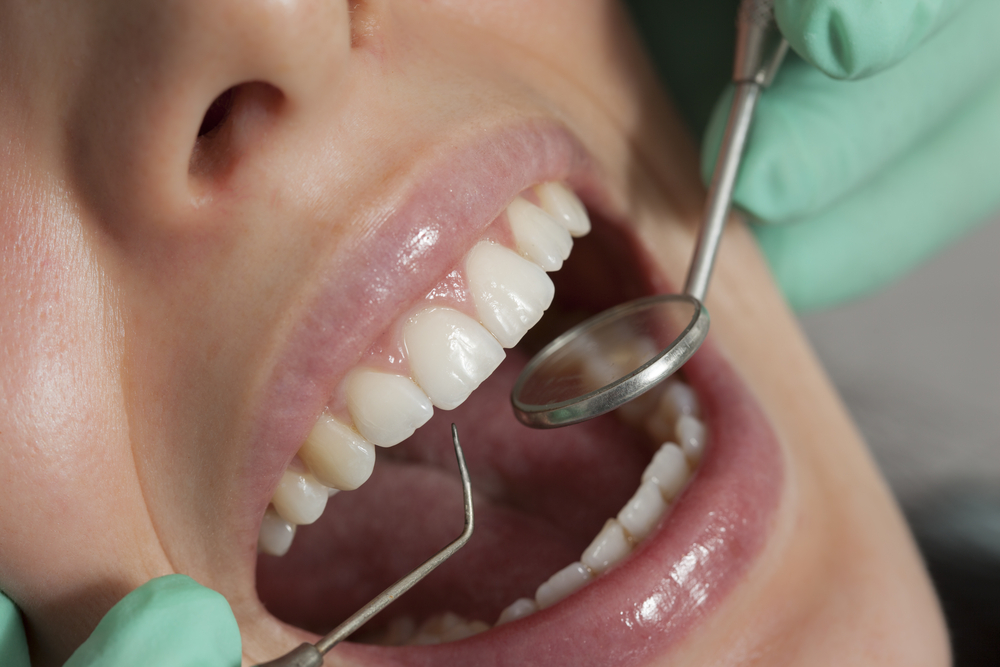 Bedford dental practice to offer free oral cancer screening in April