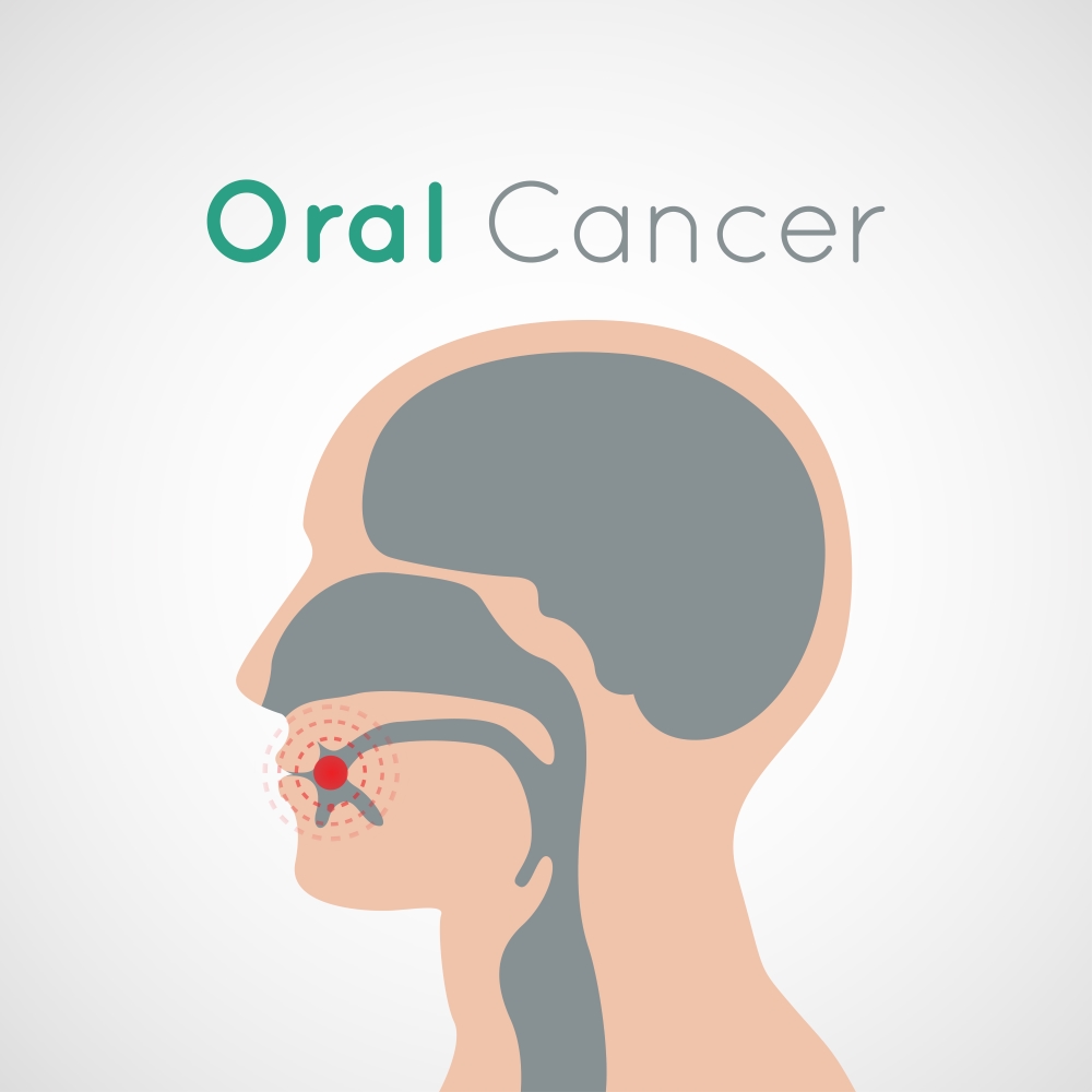 Do you know the warning signs of oral cancer?