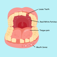Are you familiar with the signs of oral cancer?