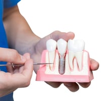 Queensway Dental set to reveal new £50,000 implant suite