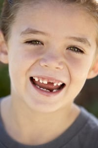 Genetic Mutations Cause Dental and Oral Anomalies