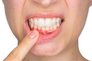 Leading gum specialist reveals the oral health red flags patients should never ignore