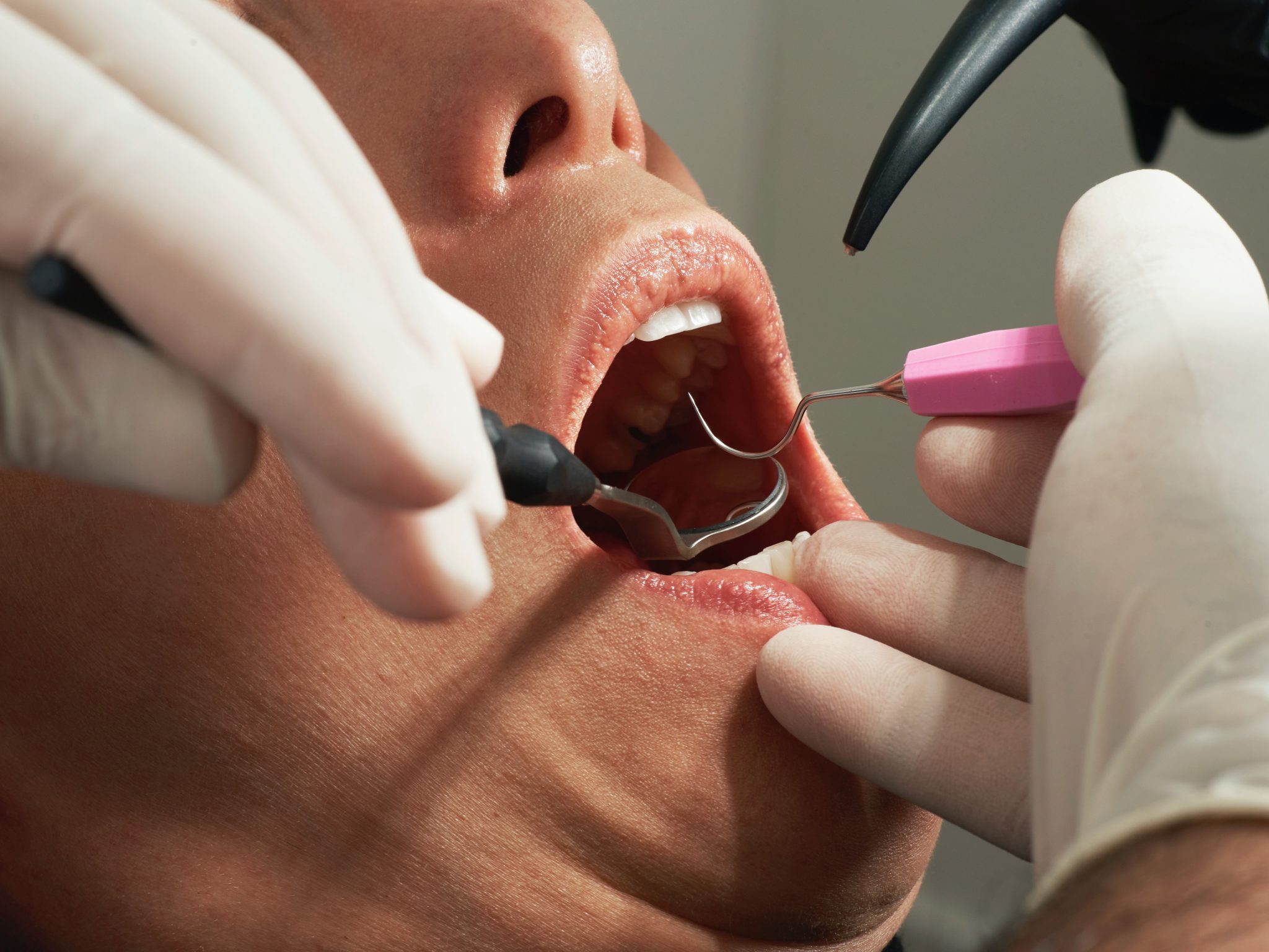 Dental charity urges the government to increase funding to tackle backlogs