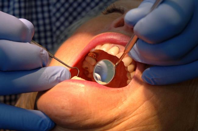 NHS chiefs insist they are doing everything possible to improve access to dental services in North Yorkshire