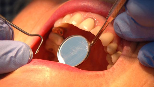 Camden health watchdog issues warning over growing dental health inequalities