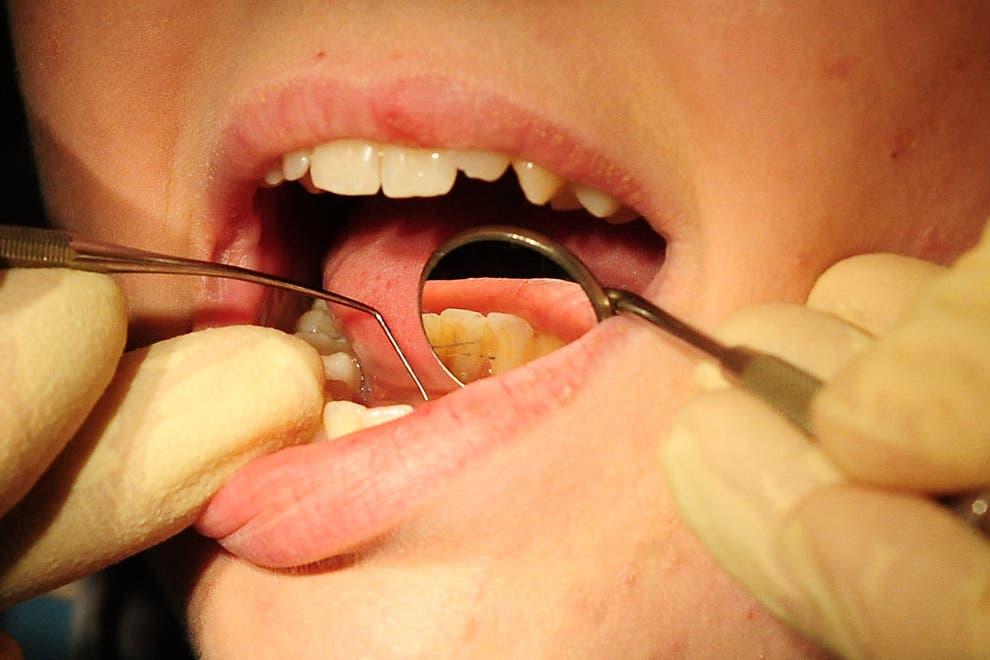 Figures show 70% drop in courses of child dental treatment