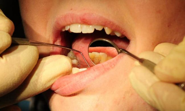 Dental appointment numbers fall by over 60% in Bracknell Forest