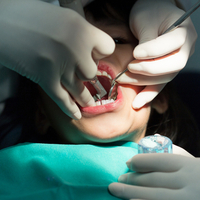 Almost 1,000 children needed teeth extracting in hospital in Bradford in 2019/2020