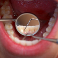 Newcastle MP calls for urgent action to prevent dental crisis from getting worse