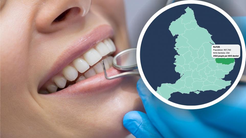 New interactive map reveals scale of dental access issues in East Anglia
