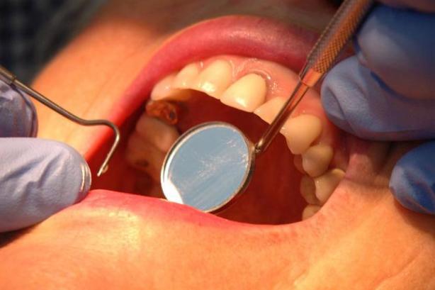 Patients scramble to find a new dentist, as Bupa confirms summer closures