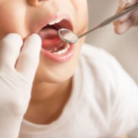 Somerset parents struggle to find a dentist for their children