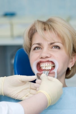 French dentists cutting down on mercury fillings