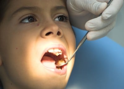 Mobile Clinic Provides Free Dental Services In Virginia 