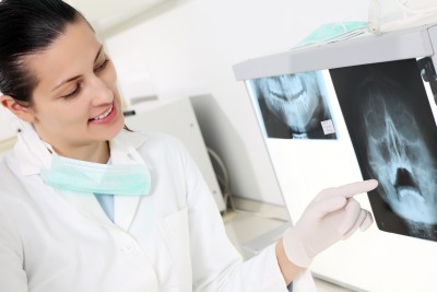 Dental X-Rays Can Determine Fracture Risk 