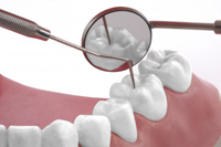 Laser Technology Provides Alternative to Painful Gum Disease Treatments