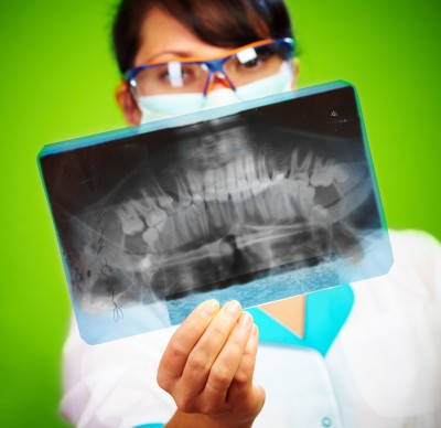 Dental X-rays ordered to confirm the age of suspected murderer